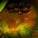 Pseudophakic RRD, S/P Buckle/Vit. w/ Residual Gas Fish Eggs OD Pseudophakic RRD, S/P Buckle/Vit. w/ Residual Gas Fish Eggs OD