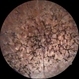 Bone Corpuscle Pigments Bone Corpuscle Pigments