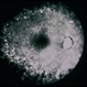 Necrotizing Retinitis Necrotizing Retinitis