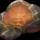 Uveal Effusion Syndrome