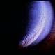 Wilson's Disease Wilson's Disease