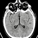The Effects of Blunt Trauma The Effects of Blunt Trauma