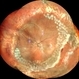 Attached Retina in a Silicon Oil Filled Buckled Eye with Retinectomy Attached Retina in a Silicon Oil Filled Buckled Eye with Retinectomy