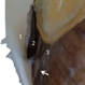 Magnification of Enucleated Eye and Iridocorneal Angle Magnification of Enucleated Eye and Iridocorneal Angle