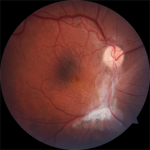 Anatomy of the Eye - Retina-Vitreous Surgeons of CNY