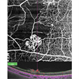 Retinal neovascularization Retinal neovascularization