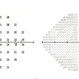 Optic Disc Drusen Optic Disc Drusen