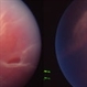 Retinal detachment and responsible tear