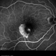 Retinal Pigment Epithelium Retinal Pigment Epithelium