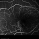 Retinal Pigment Epithelium Retinal Pigment Epithelium