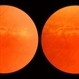The Peripheral Retina in Profile: A Stereoscopic Atlas The Peripheral Retina in Profile: A Stereoscopic Atlas