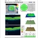 Vitreal Macular Traction